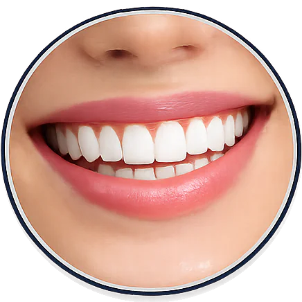 Teeth Whitening Federal Way